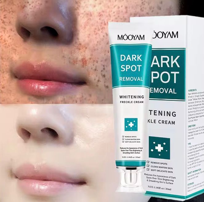Dark Spot Remover Cream
